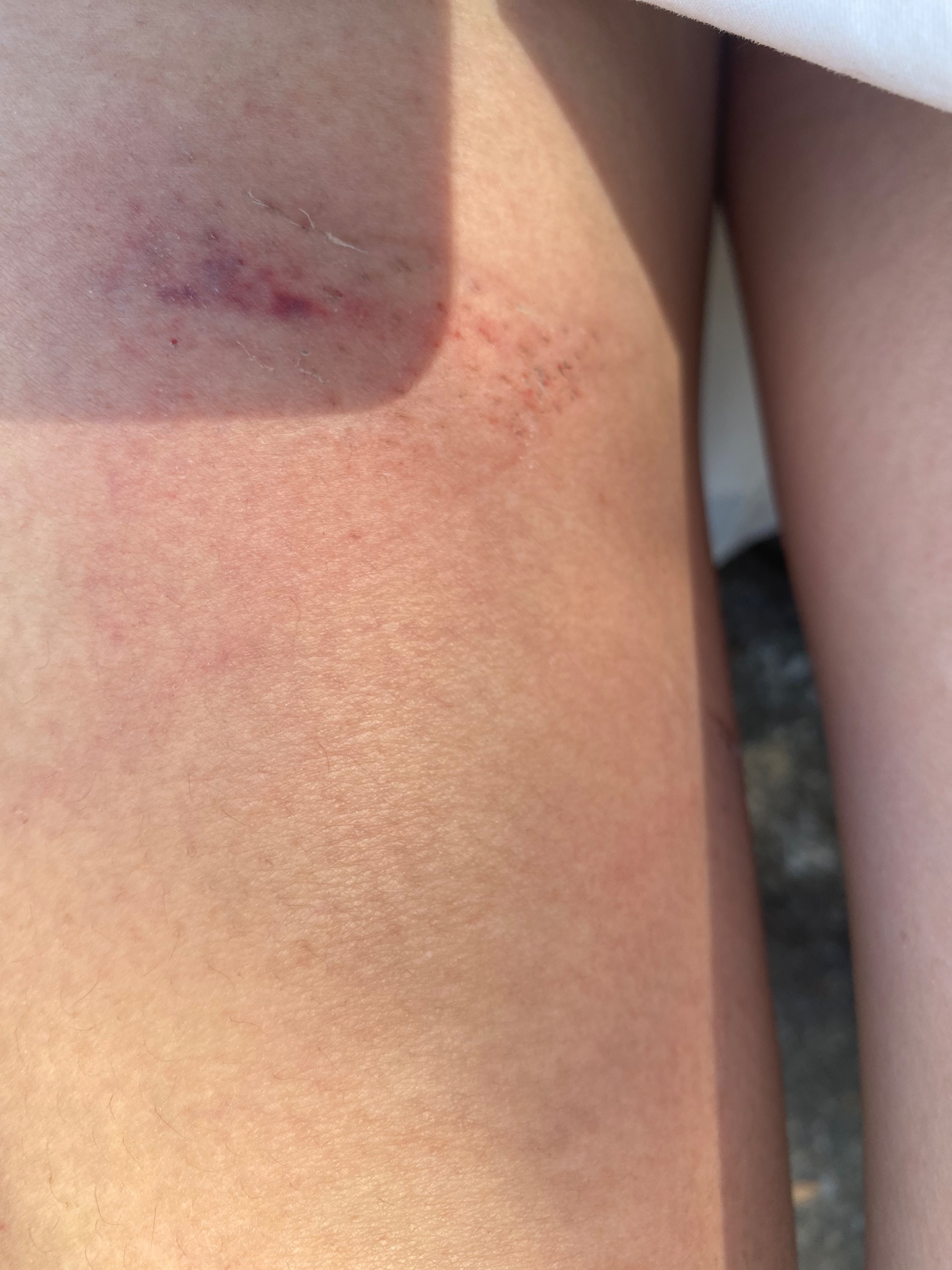 協尋114/11/7上午，大約11:10左右，新生南路一段161巷，右轉出巷口到新生南路一段（大馬路約10米），行車紀錄器的畫面。